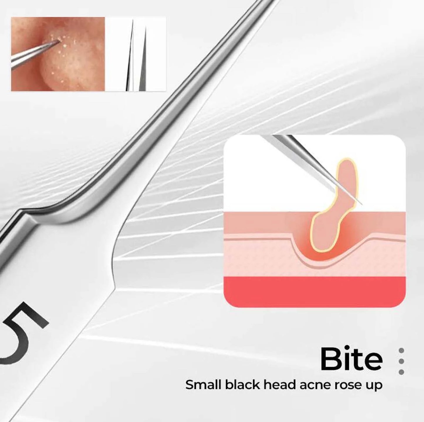 Facial Blackhead Remover Tweezers, Stainless Steel Acne Clip Acne Removal Set Beauty Tool Tweezers, Beauty & Personal Care