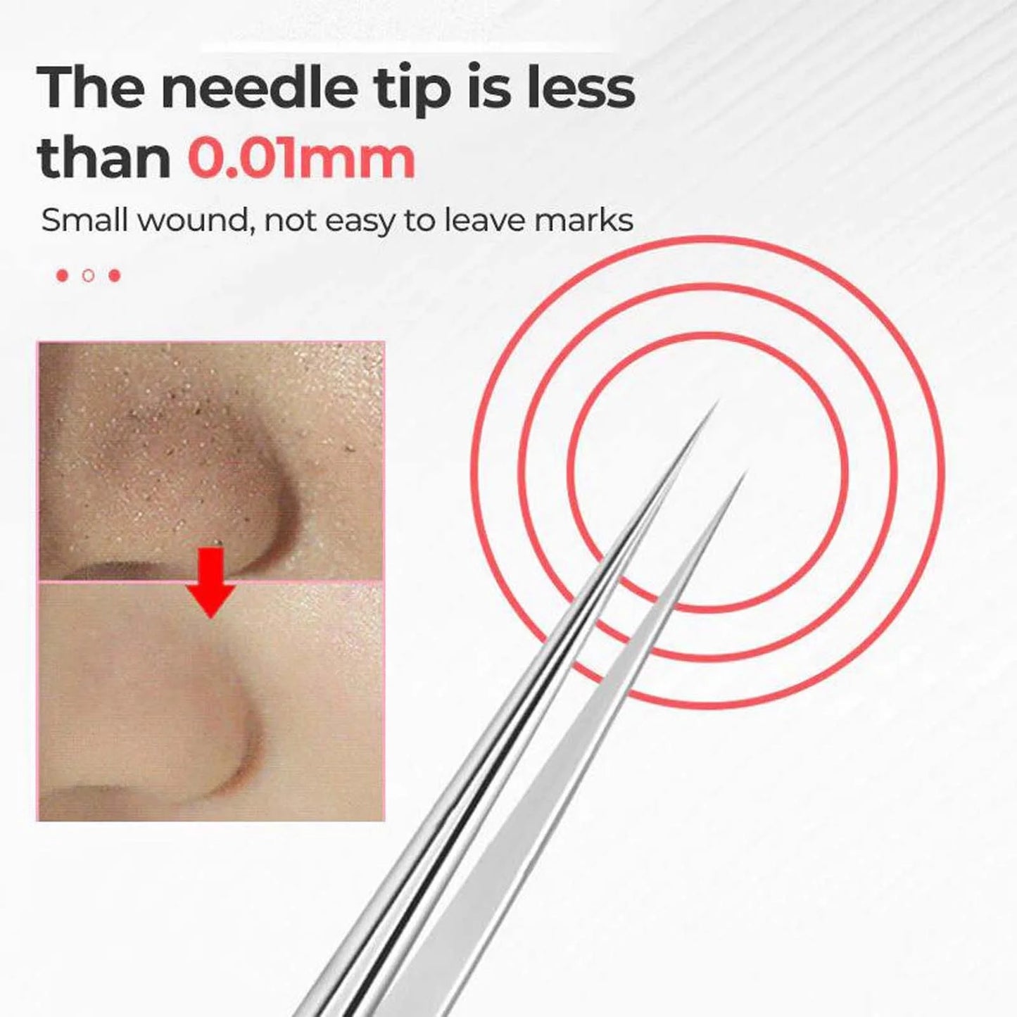 Facial Blackhead Remover Tweezers, Stainless Steel Acne Clip Acne Removal Set Beauty Tool Tweezers, Beauty & Personal Care