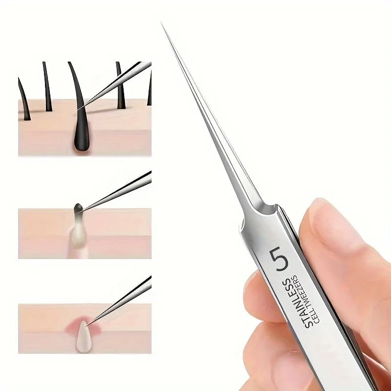 Professional Blackhead Remover Tool, Acne Extractor