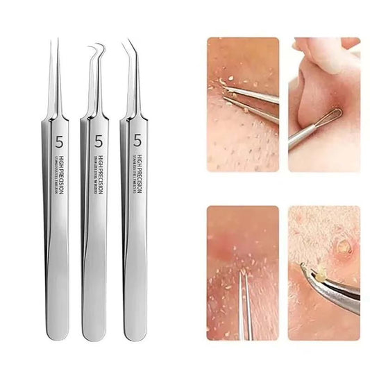Facial Blackhead Remover Tweezers, Stainless Steel Acne Clip Acne Removal Set Beauty Tool Tweezers, Beauty & Personal Care