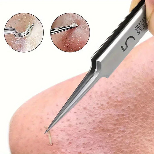 Precision Blackhead & Acne Tweezers – Stainless Steel Extractor Tool